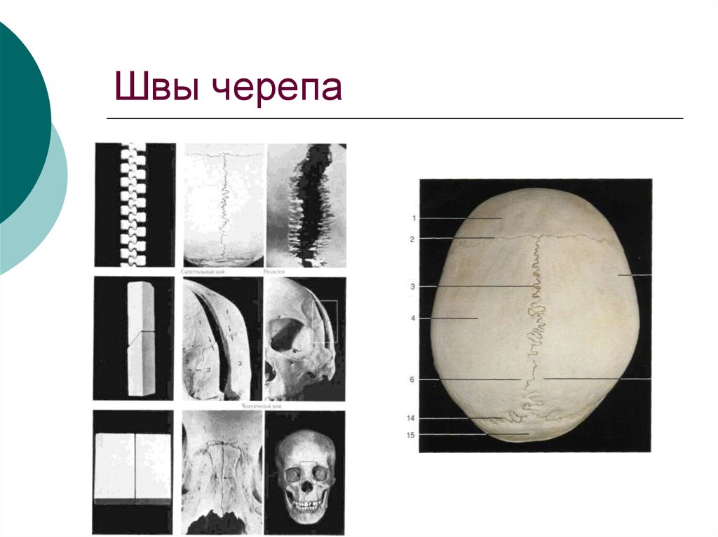 Швы свода черепа. Плоские швы черепа анатомия. Швы черепа анатомия.