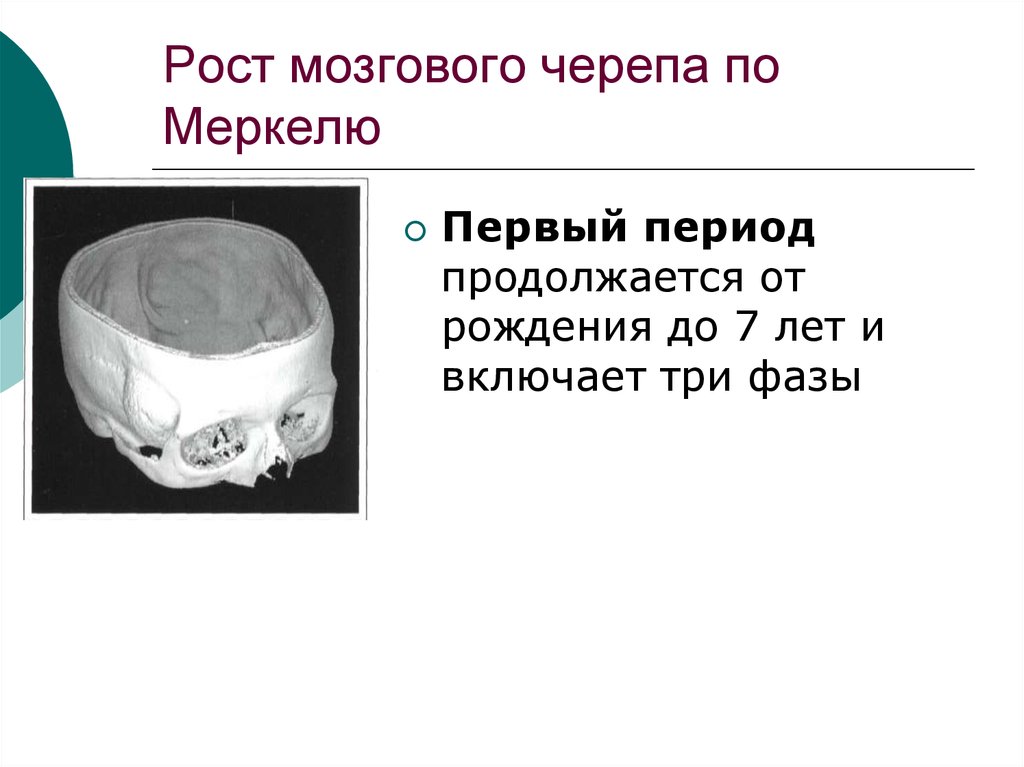 Аномалии мозгового черепа. Развитие мозгового черепа.