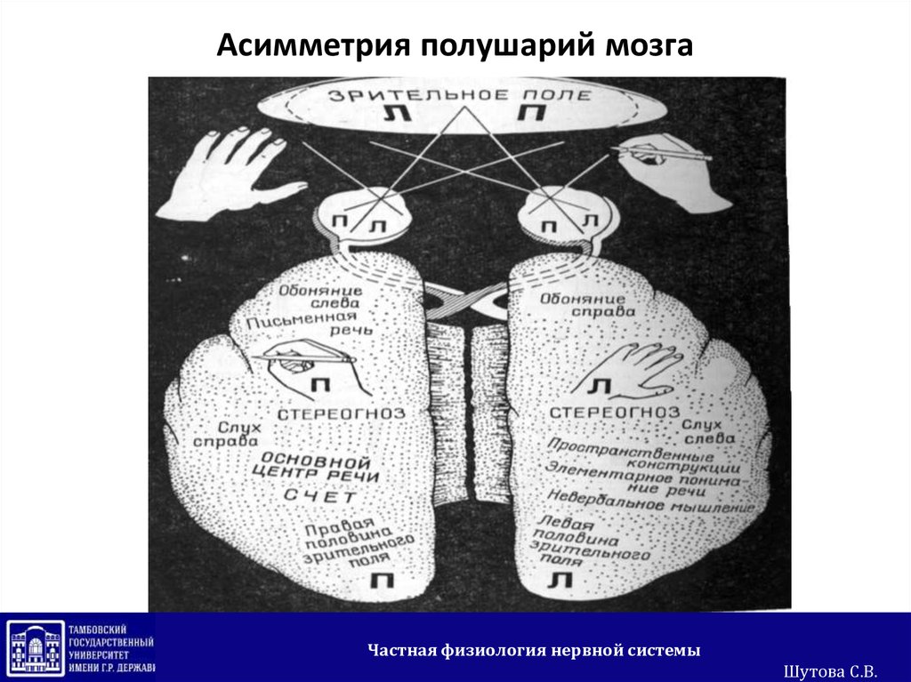 Функциональная асимметрия мозга картинки