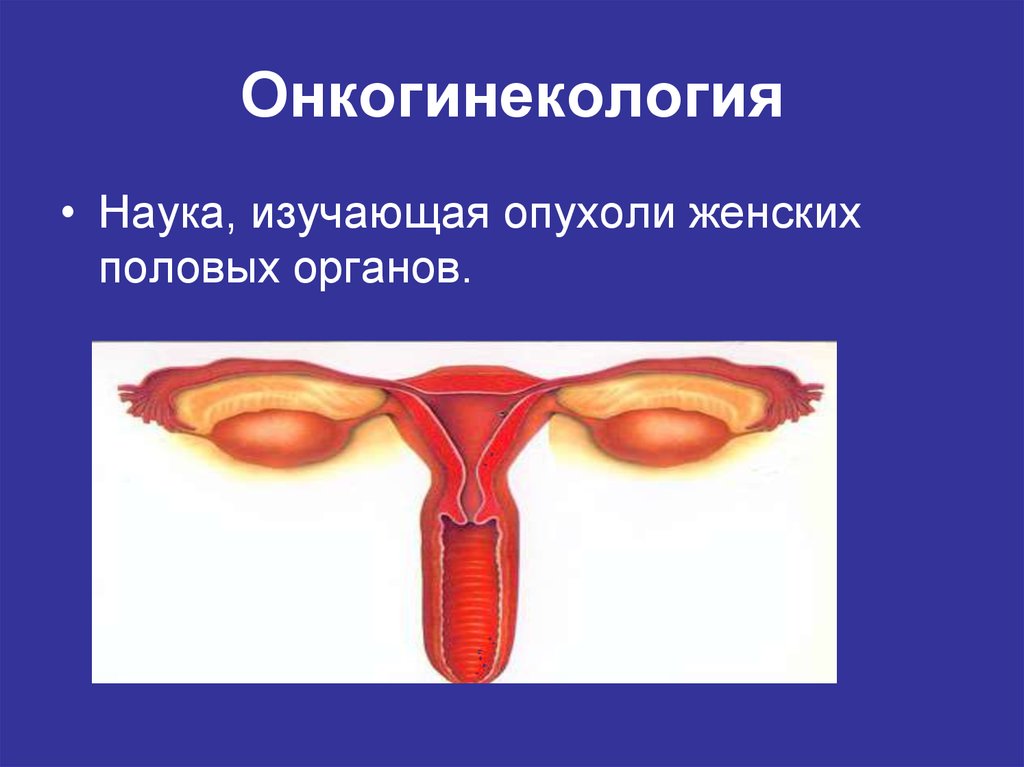 Наука изучающая опухоли. Опухоли женских половых органов. Онкогинекология профилактика. Онкогинекология презентация.