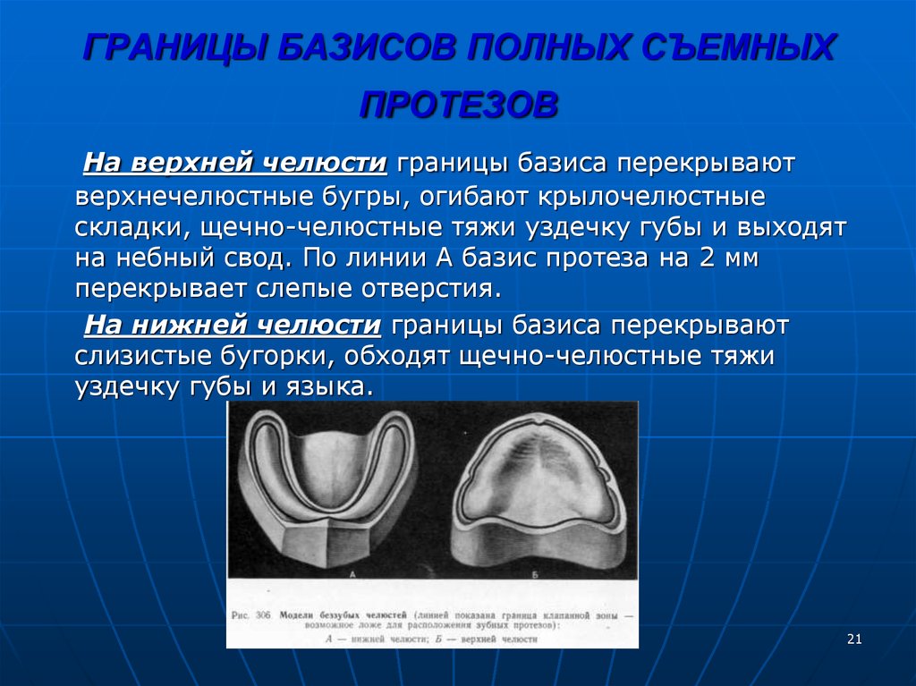 Н ч 3. Границы полного съемного протеза на верхней и нижней челюсти. Граница базиса протеза на верхней челюсти. Границы базиса съемного пластиночного протеза. Границы протеза на нижнюю челюсть.