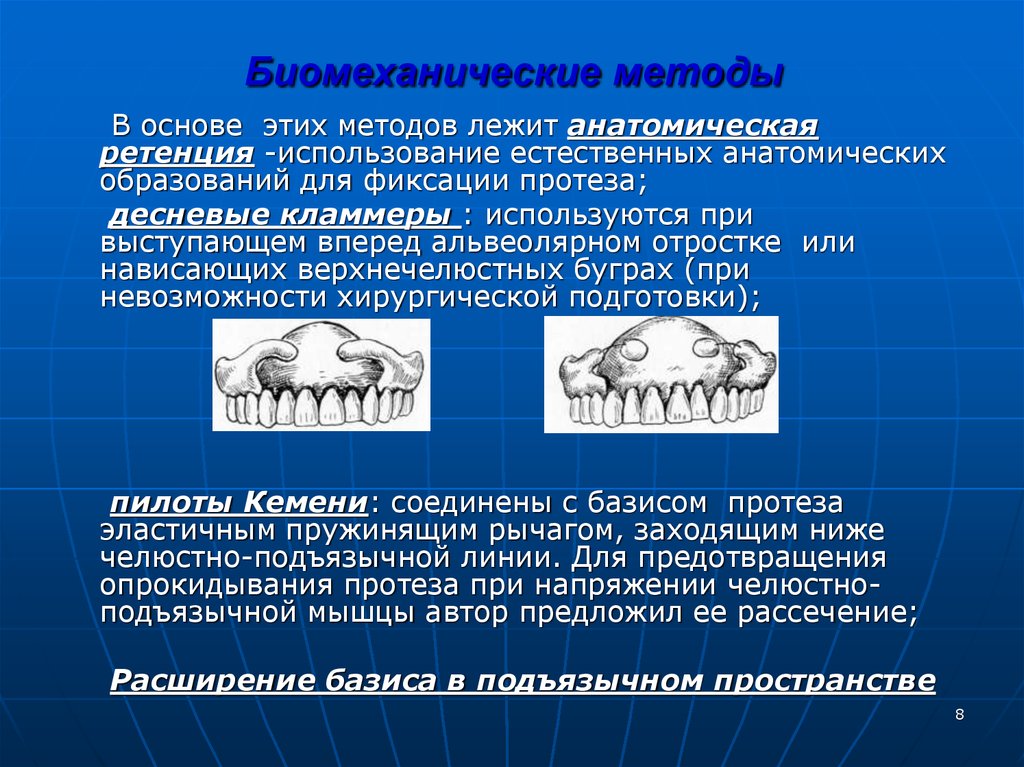 Что лежало в основе. Биомеханический метод фиксации протезов. Фиксация и стабилизация протезов методы. Методы фиксации и стабилизации съемных протезов. Методы фиксации и стабилизации съемных пластиночных протезов.