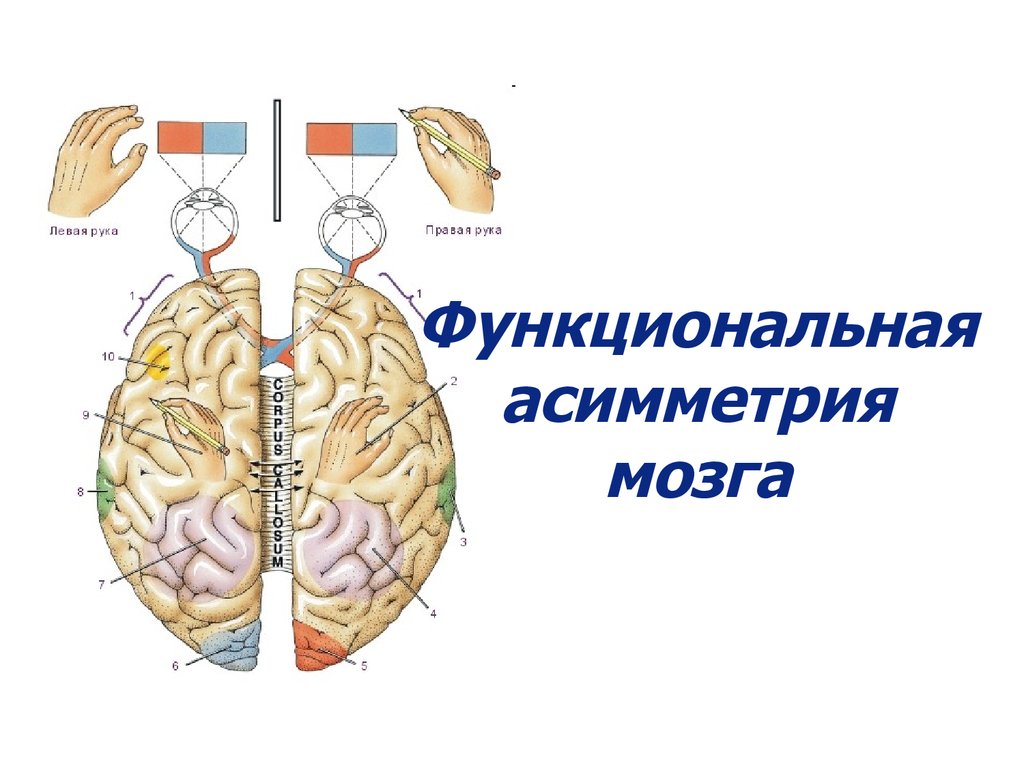 Функциональная асимметрия мозга картинки