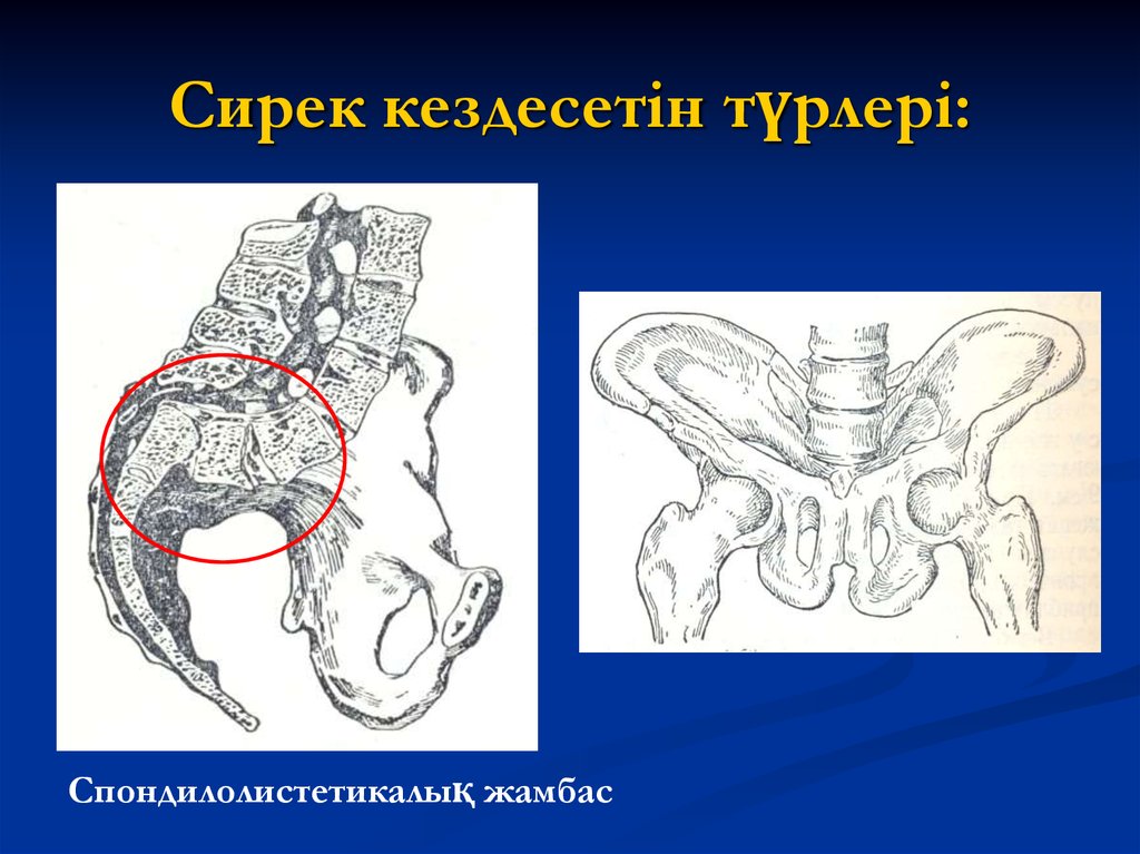 Тар жамбас презентация