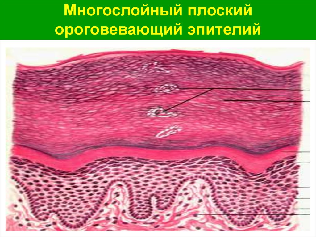 В эпителиях присутствуют. Многослойный плоский эпителий гистология. Многослойный плоский ороговевающий эпителий строение. Строение многослойного ороговевающего эпителия гистология. Многослойный неороговевающий эпителий строение.