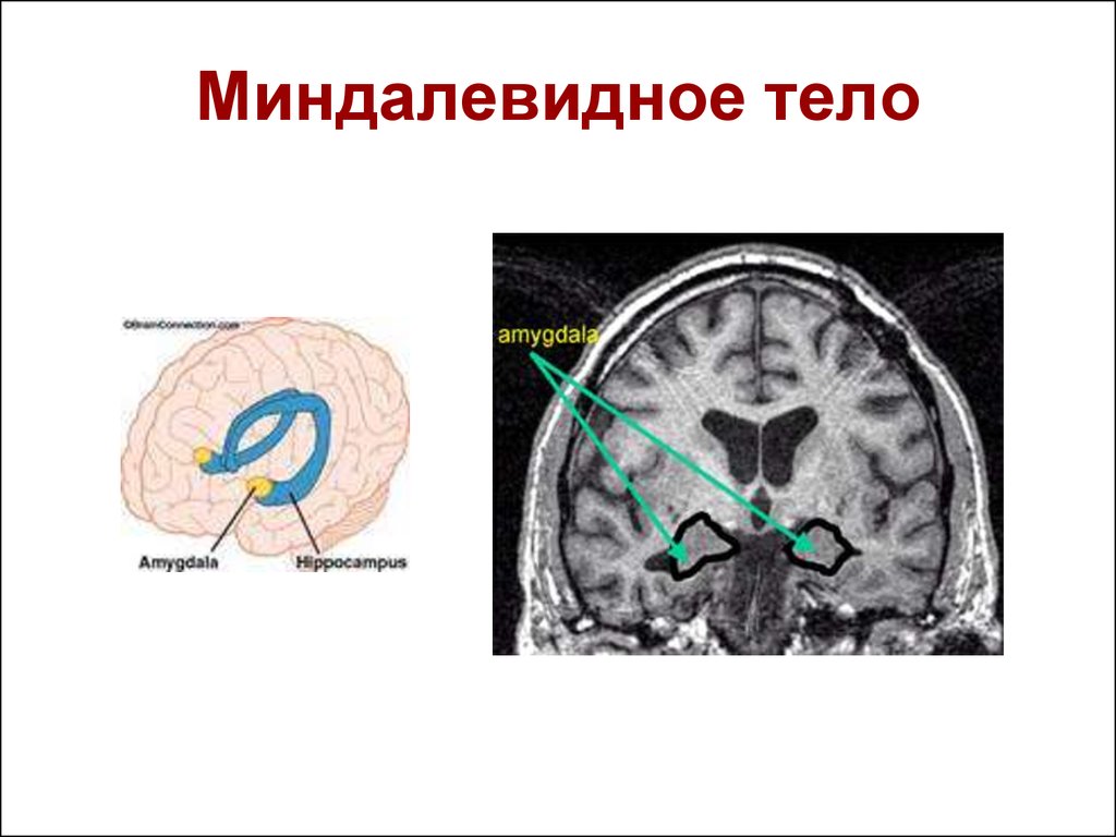Отросток мозга 4. Миндалевидное тело Амигдала функции. Функции миндалевидного ядра головного мозга. Миндалина мозга функции. Миндалевидное тело в головном мозге мрт.