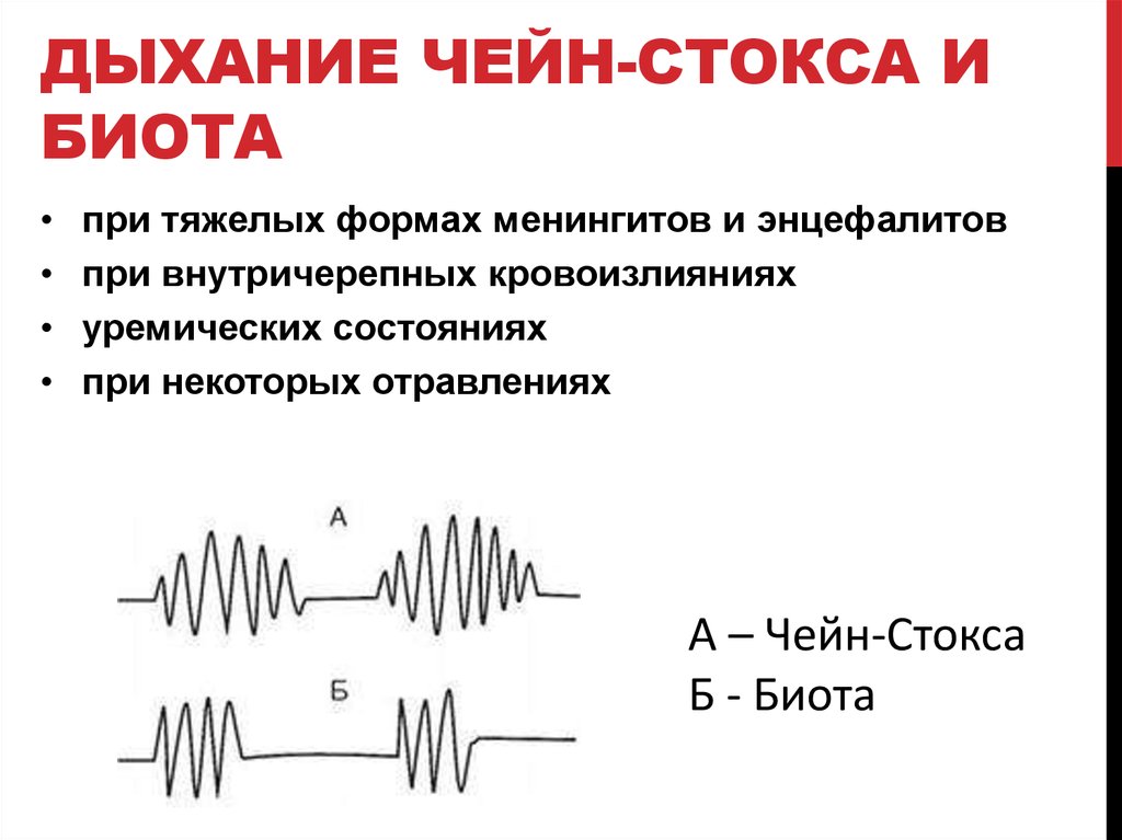 Ритм дыхания. Дыхание Биота Чейна Стокса Куссмауля. Ритм дыхания Чейна-Стокса. Типы дыхания Куссмауля Чейна Стокса Биота. Дыхание Чейна Стокса.