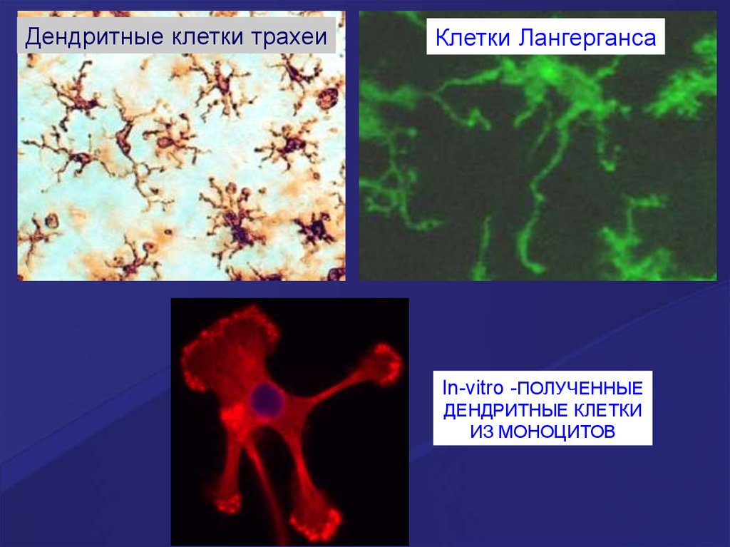 Естественные киллеры презентация