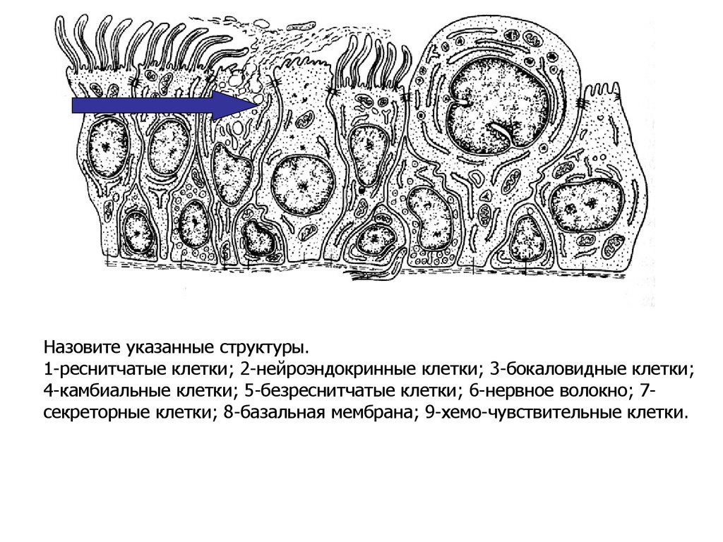 Назовите указанную структуру. Нейроэндокринные клетки. Безреснитчатые клетки. Бокаловидные секреторные клетки. Реснитчатые и секреторные клетки.