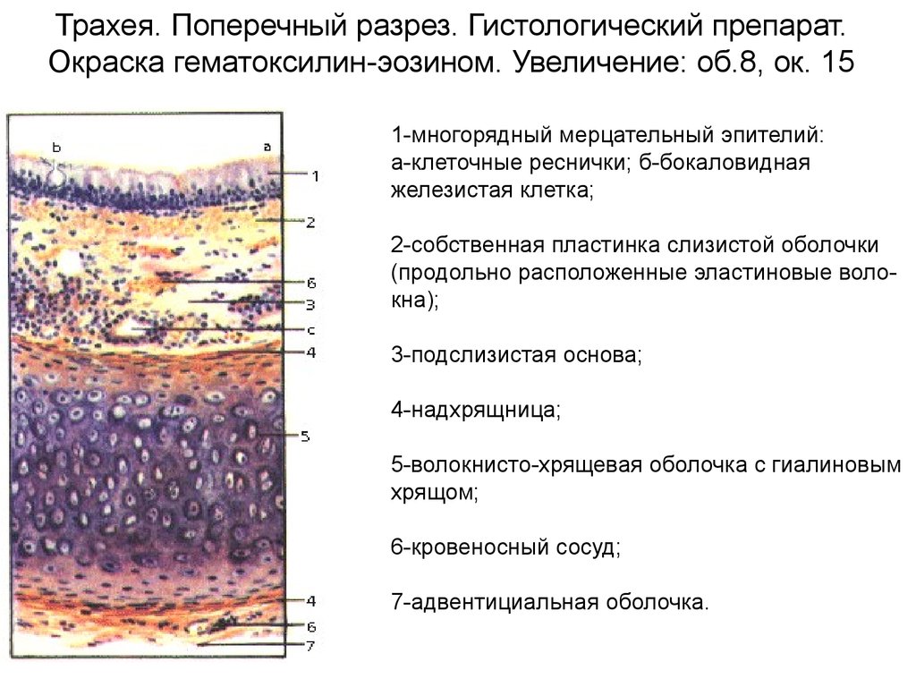 Увеличение слой. Срез трахеи гистология препарат. Трахея гистология препарат. Трахея поперечный срез гистология. Гистологическое строение трахеи.