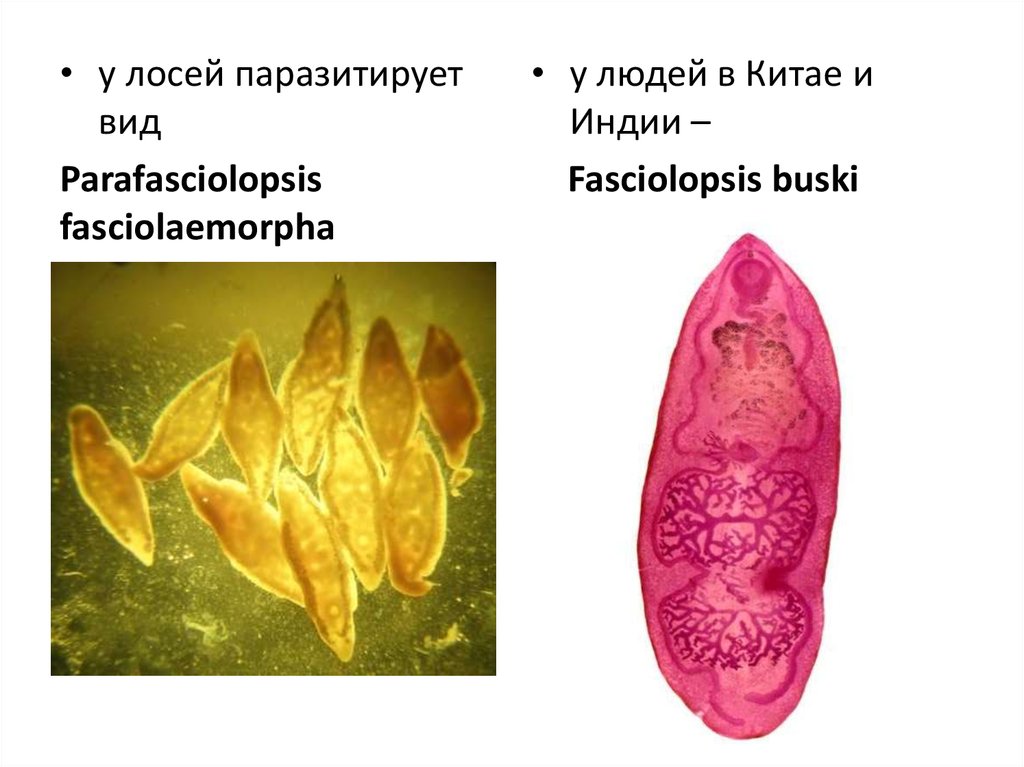 Яйца печеночного сосальщика