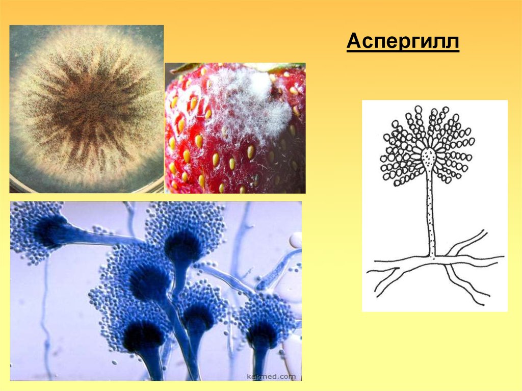 Аспергиллез микробиология презентация