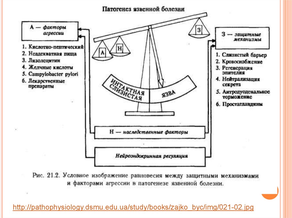 Язвенная болезнь желудка патофизиология презентация