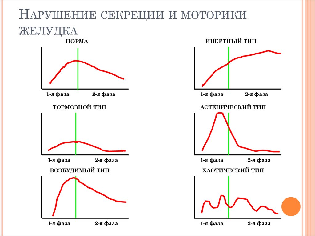 Типы секреции. Типы патологической секреции желудочного сока. Типы желудочной секреции графики. Типы кривых желудочной секреции. Дополните перечень типов патологической желудочной секреции:.