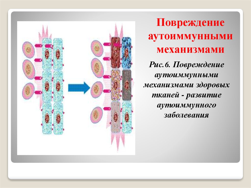 Презентация на тему аутоиммунные заболевания