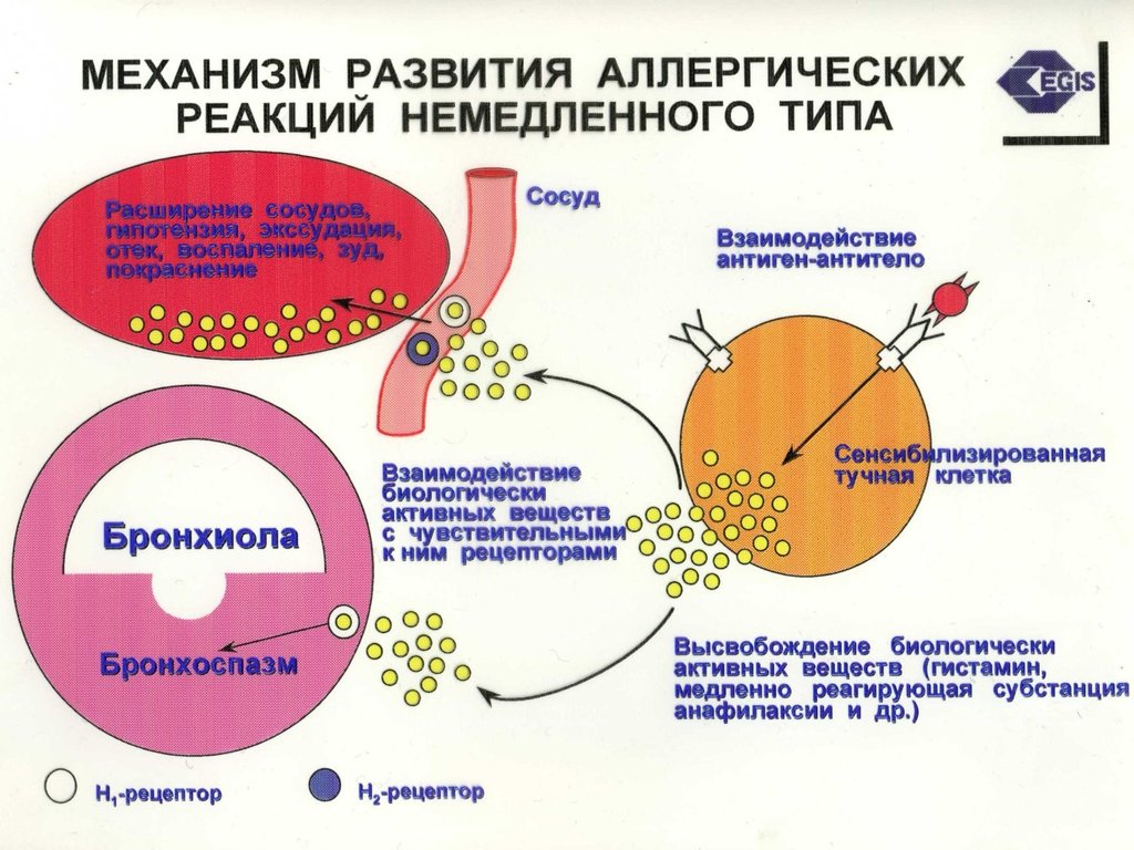 Немедленные аллергические реакции. Аллергическая реакция 1 типа механизм. Схема аллергической реакции немедленного типа. Механизм возникновения аллергической реакции. Схема развития аллергической реакции 1 типа.