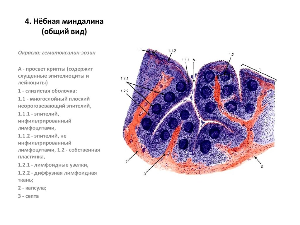 4. Нёбная миндалина (общий вид)