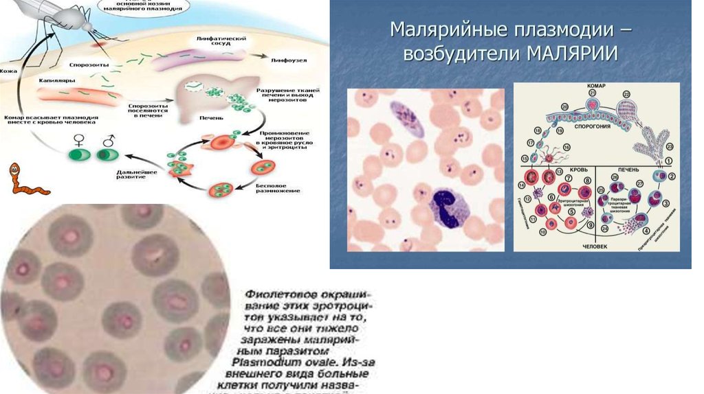 Малярия возбудитель. Малярийный плазмодий заболевание. Малярийный плазмодий вызывает заболевание. Малярийный плазмодий лихорадка. Заражение малярийным плазмодием.