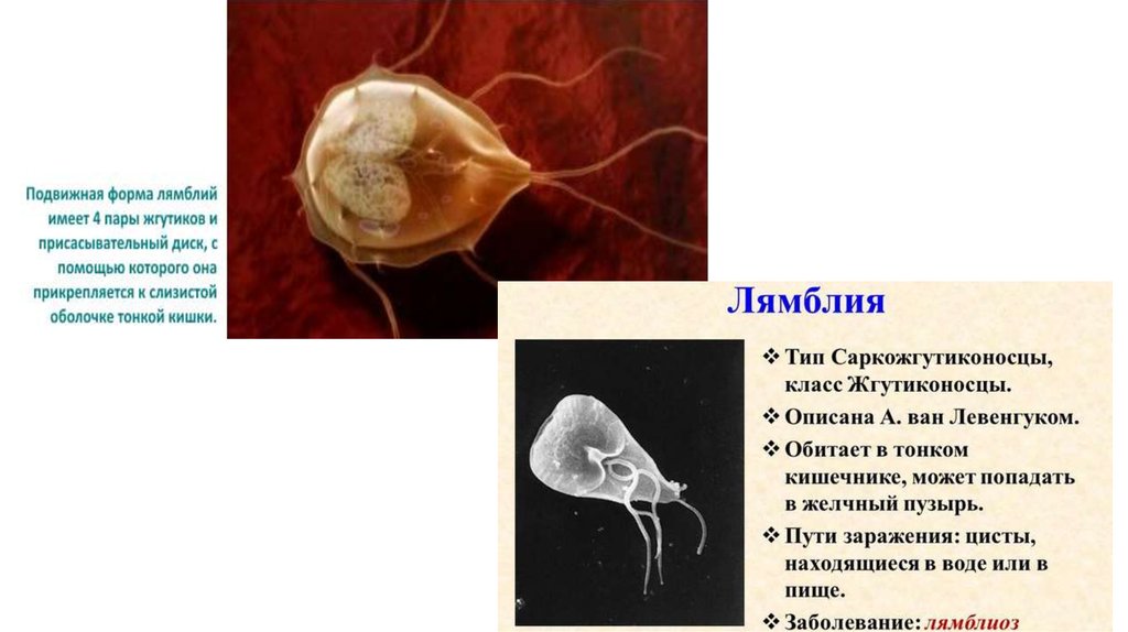 Заболевания вызываемые простейшими. Сонная болезнь лямблия. Лямблии Тип класс.