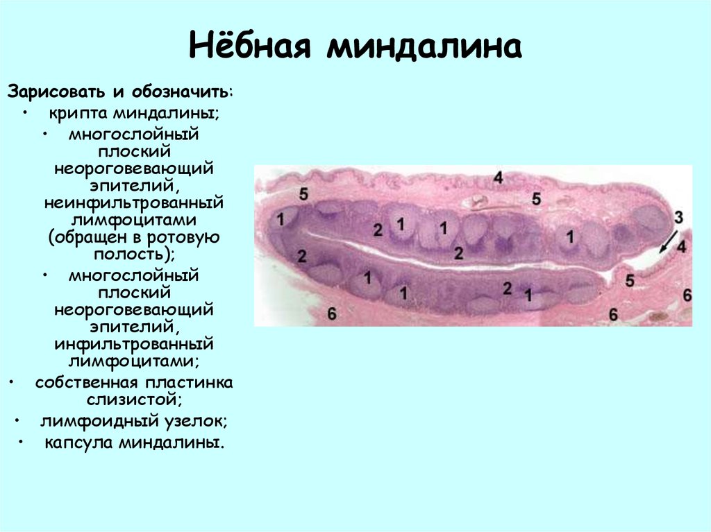 Миндалина гистология рисунок