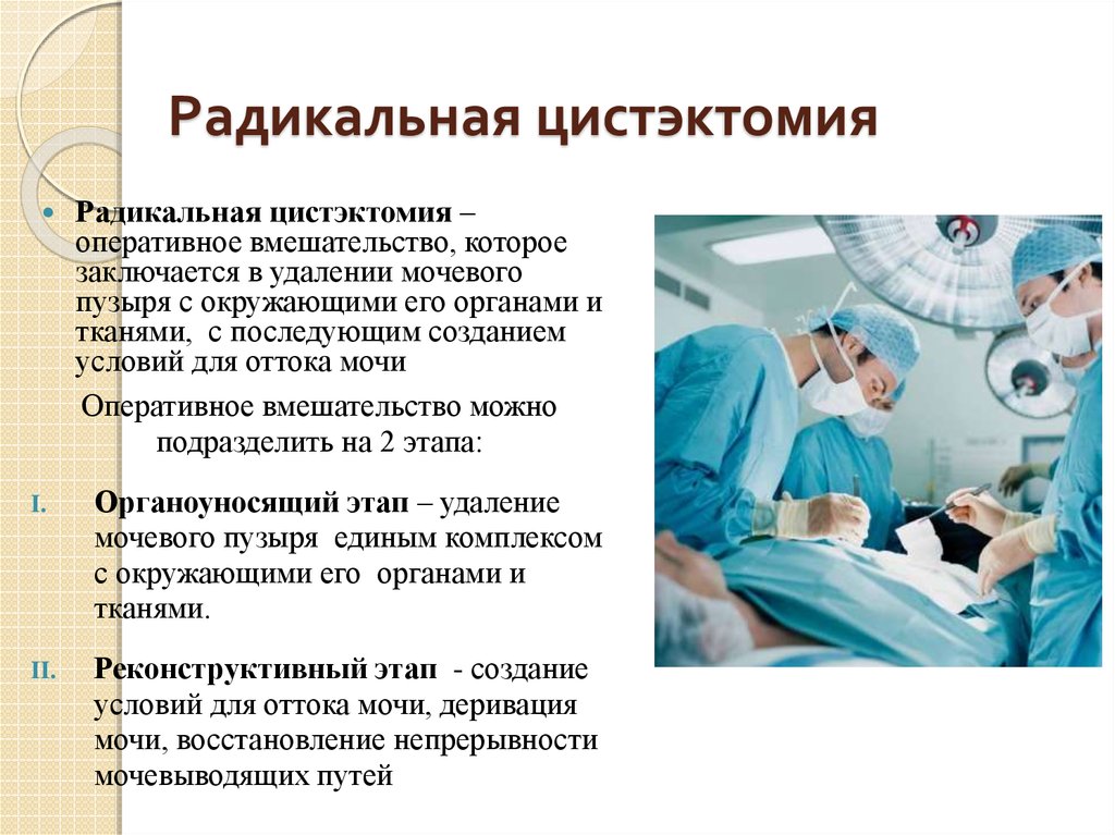 Удаление мочевого пузыря при раке. Цистэктомия протокол операции гинекология. Лапароскопическая радикальная цистэктомия. Цистэктомия яичника лапароскопия. Радикальная цистэктомия мочевого пузыря презентация.