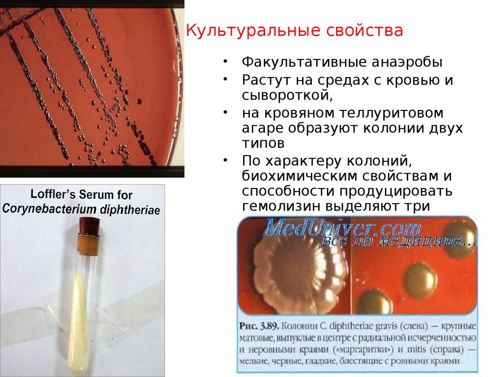 Возбудитель дифтерии является. Corynebacterium diphtheriae культуральные свойства. Биовары возбудителя дифтерии. Элективные питательные среды для возбудителя дифтерии. Corynebacterium diphtheriae питательная среда.