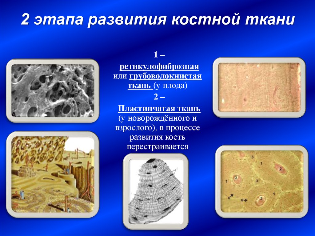 Основные компоненты костной ткани. Грубоволокнистая и пластинчатая костная ткань. Ретикулофиброзная костная ткань. Грубоволокнистая костная ткань остеоны. Строение ретикулофиброзной костной ткани.