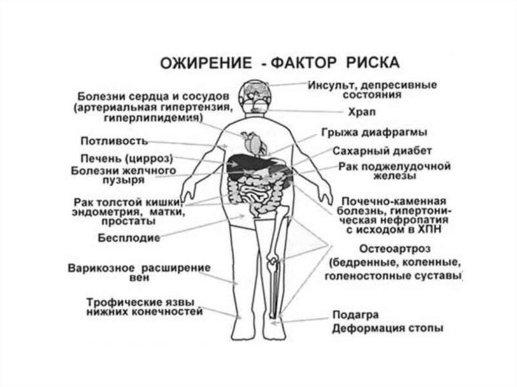 Картинки типы ожирения