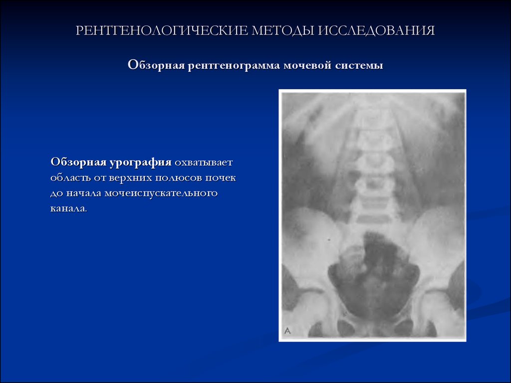 Рентгенологические методы исследования презентация