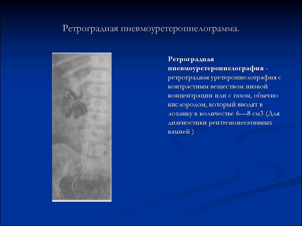 Семиотика урологических заболеваний презентация