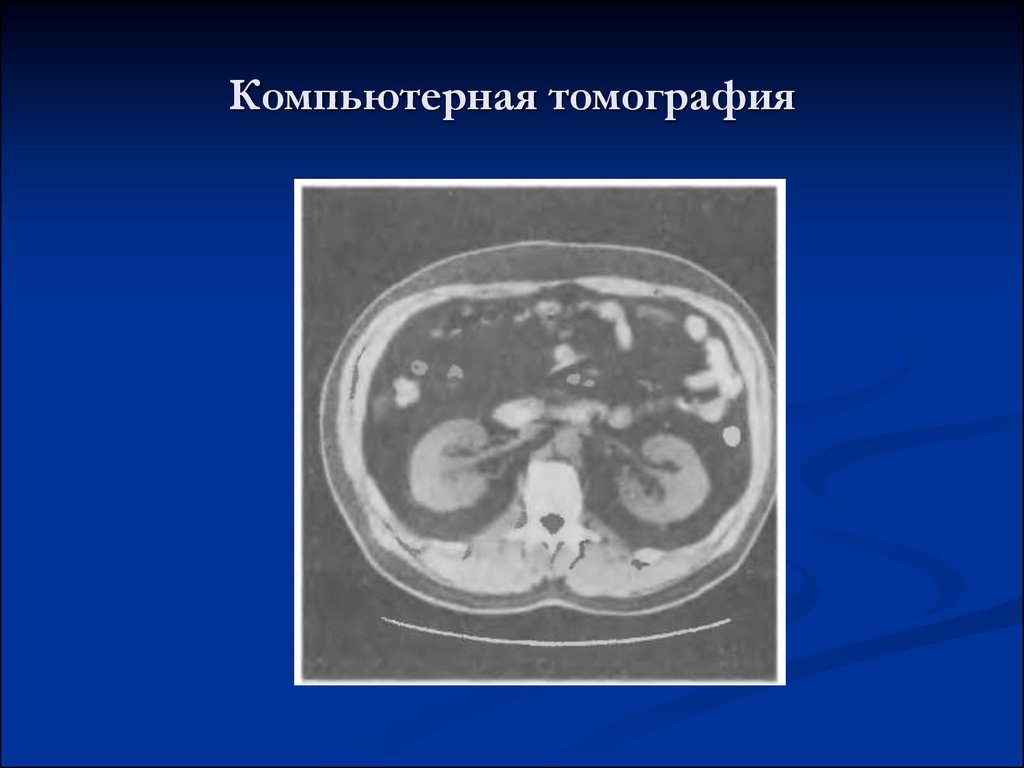 Семиотика урологических заболеваний презентация