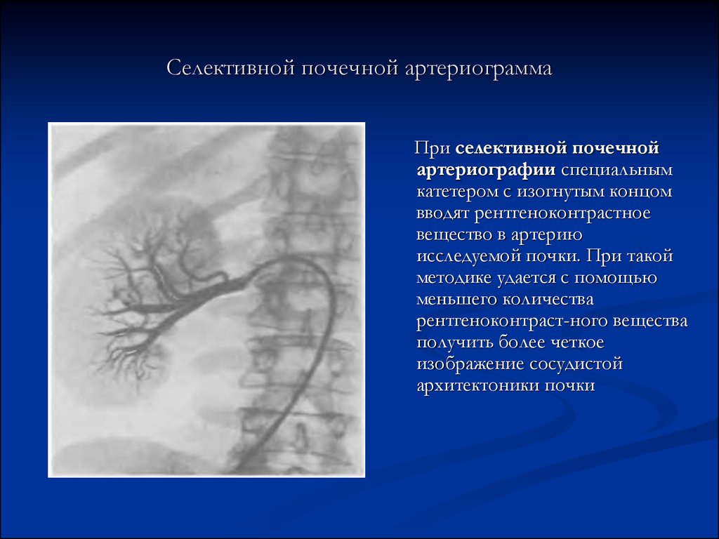 Почечная ангиография презентация