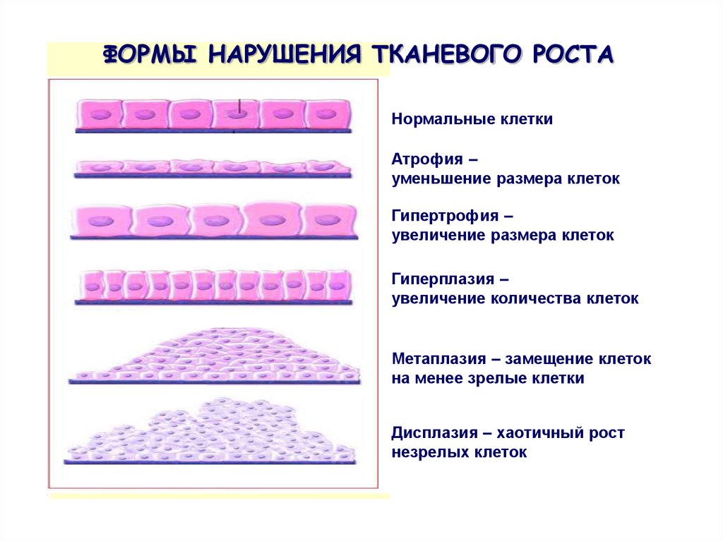 Нарушение клетки. Формы нарушения тканевого роста. Виды патологии тканевого роста. Типовые формы патологии клеток. Типовые формы патологии тканевого роста.