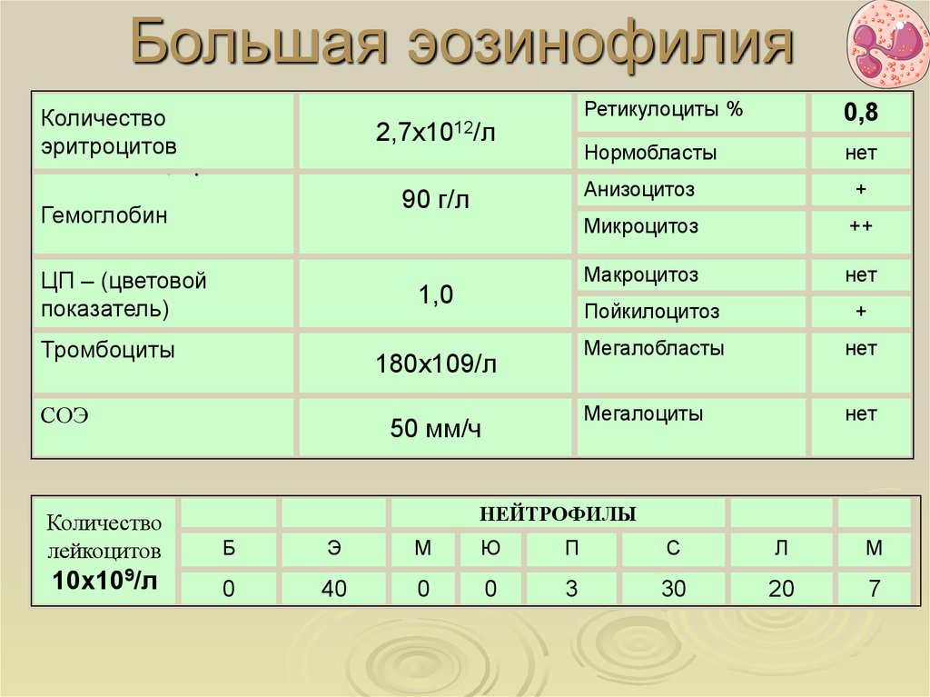 Эозинофилия заболевания. Эозинофилия. Эозинофилия характерна для. Эозинофилия степени.