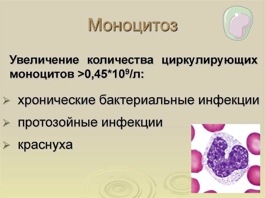 Лейкоцитоз наблюдается при. Моноцитоз. Моноцитоз в крови. Лейкопения и моноцитоз.