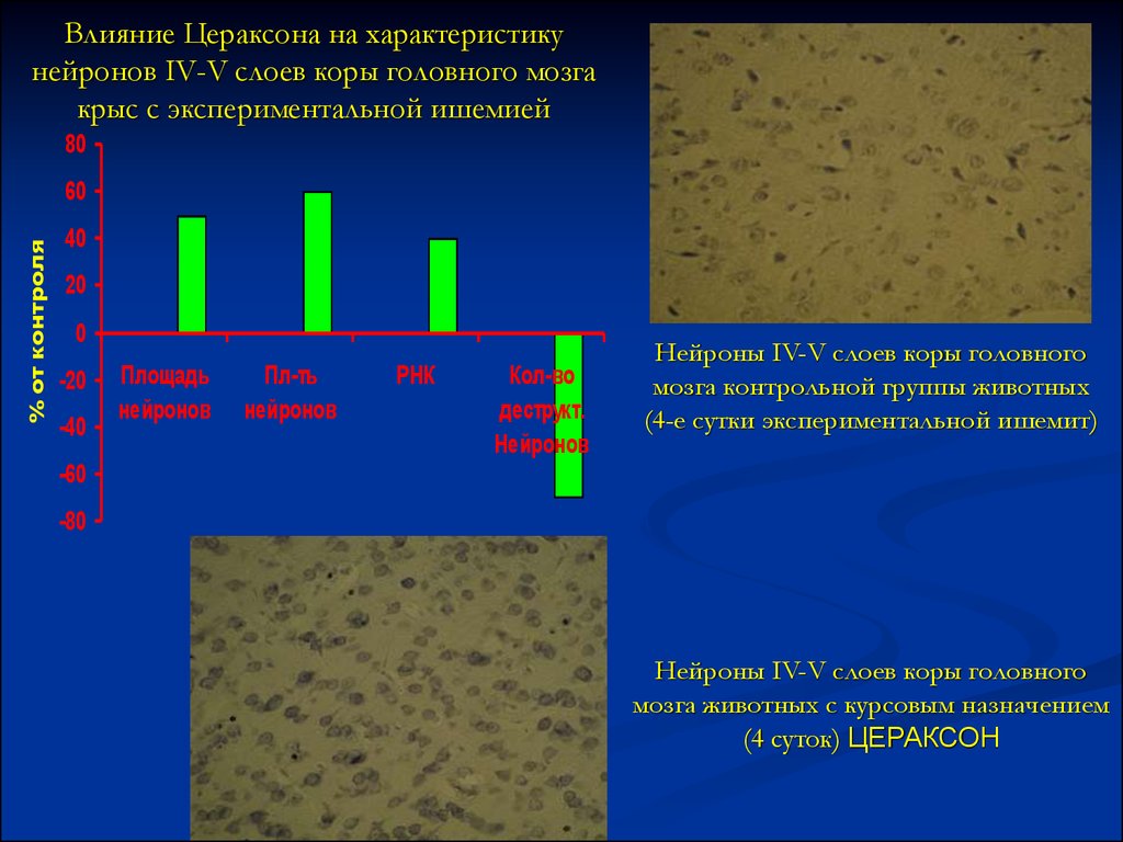 Параметры нейронов. Слои коры головного мозга. Кора головного мозга крысы препарат. Свойства нейронов. Механизм действия Цераксона.