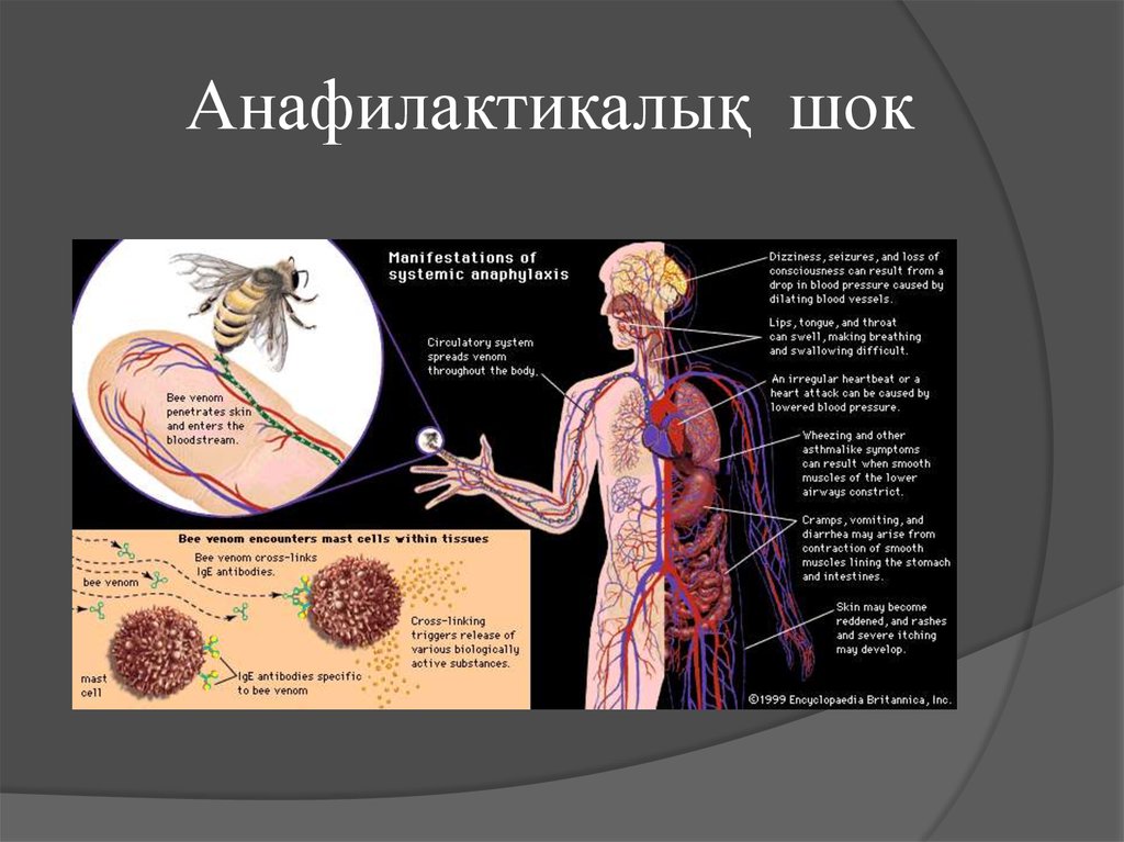 Анафилактический шок фармакология презентация