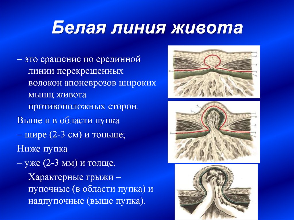 Белая линия живота. Белая линия живота анатомия функция. Срединная белая линия живота. Белая линия живота топографическая анатомия. Белая линия живота кратко.