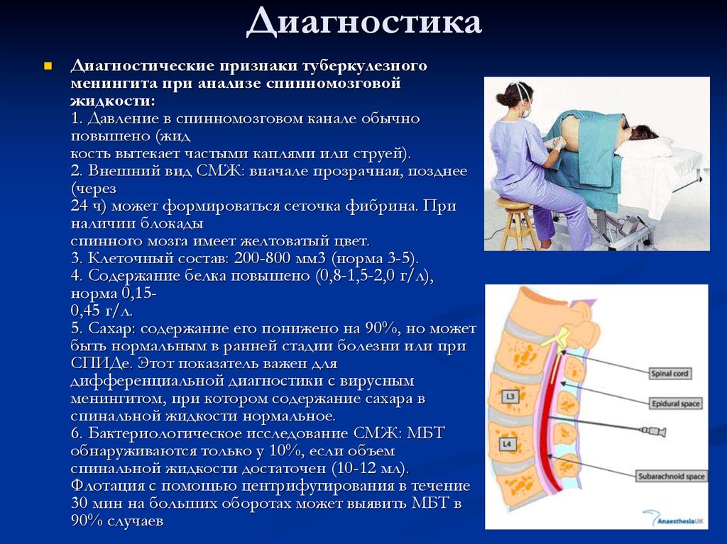 В основную схему лечения туберкулезного менингита входит