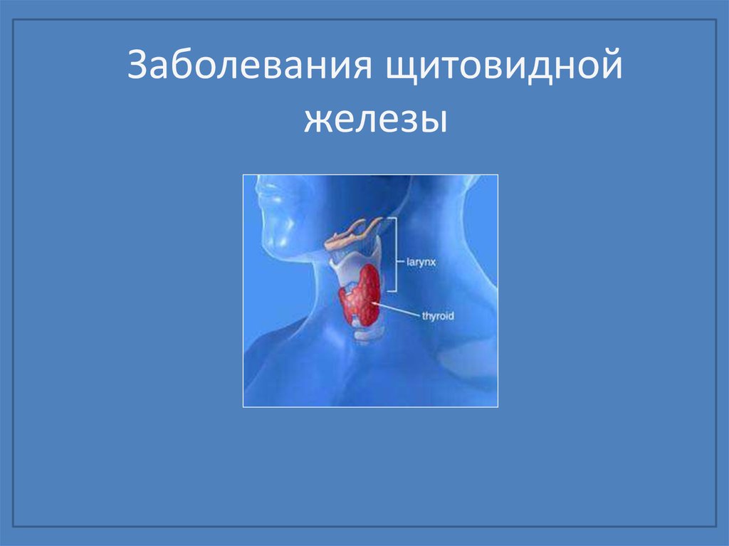 Эндокринология щитовидной железы. Заболевания щитовидки. Щитовидная железа презентация. Патология щитовидной железы.