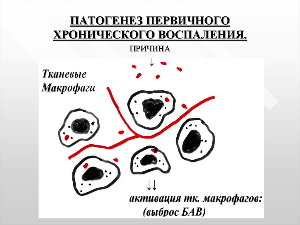 Патогенез признаков воспаления. Патогенез первично хронического воспаления. Механизм развития хронического воспаления. Схема патогенеза хронического воспаления. Патогенез первичного хронического воспаления.