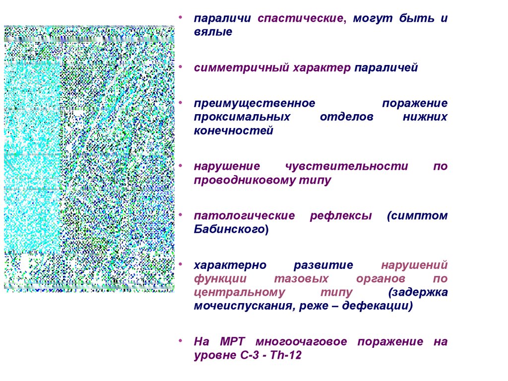 Для вялого паралича характерно