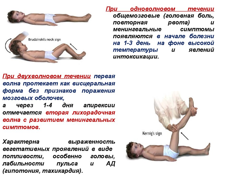 Вялые парезы и параличи травматология презентация