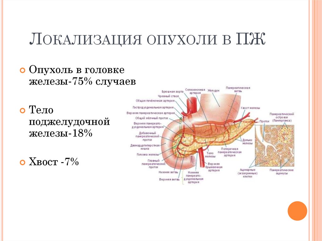 Онкология поджелудочной железы