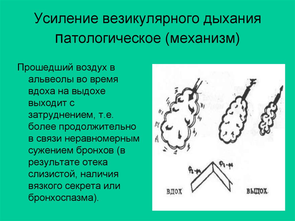 Везикулярное дыхание схема