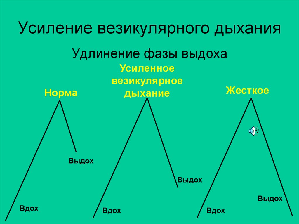 Схема везикулярного дыхания