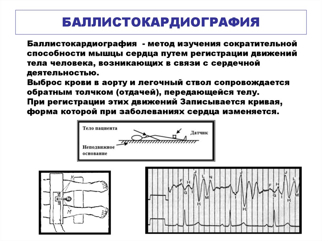 Проявление деятельности сердца. Динамокардиография и баллистокардиография. Баллистокардиография методика регистрации. Баллистокардиография физиология. Анализ Кривой баллистокардиографии.