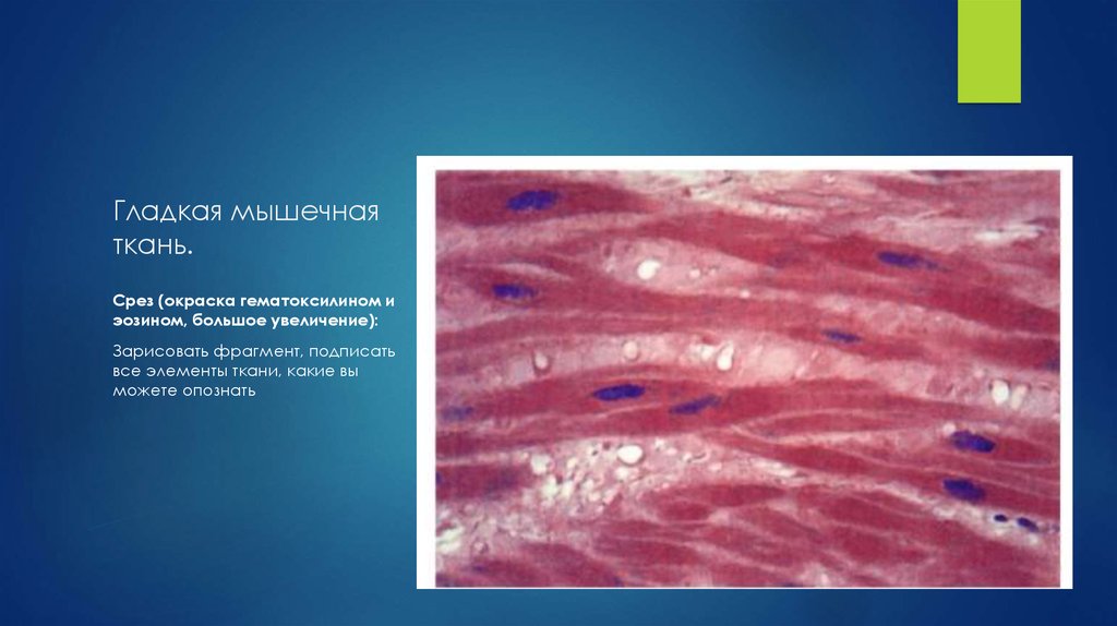 Гладкая мышечная. Гладкая мышечная ткань окраска гематоксилином и эозином. Поперечно полосатая мышечная ткань гематоксилин эозин. Гладкая мышечная ткань гематоксилин эозин. Поперечнополосатая мышечная ткань микропрепарат.