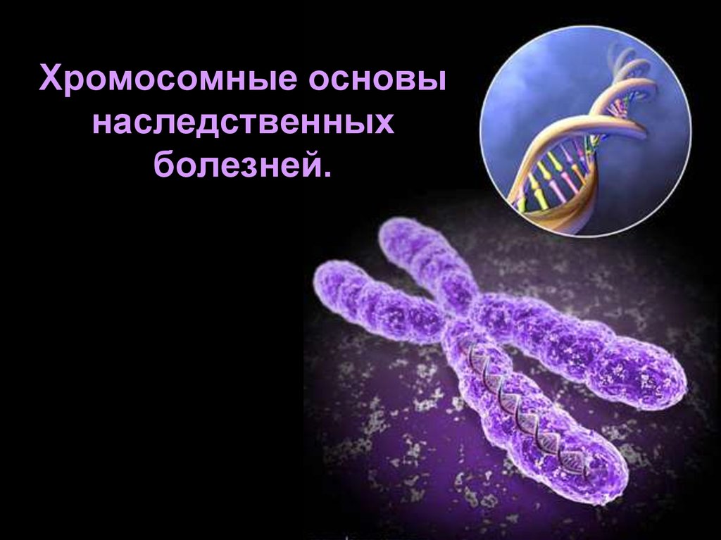 Хромосомные болезни картинки для презентации