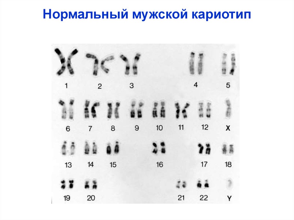 46 хромосом 1. Клетка печени кариотип. Хромосомный анализ 46 XY нормальный мужской кариотип. 46,XY нормальный мужской кариотип. Нормальный кариотип человека 46 хромосом.